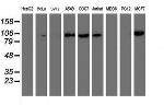 PFKP Antibody in Western Blot (WB)