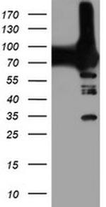 PFKP Antibody in Western Blot (WB)