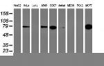 PFKP Antibody in Western Blot (WB)