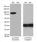 PFKP Antibody in Western Blot (WB)