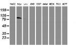 PFKP Antibody in Western Blot (WB)