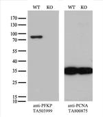 PFKP Antibody in Western Blot (WB)