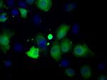 PFN1 Antibody in Immunocytochemistry (ICC/IF)