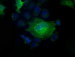 PFN1 Antibody in Immunocytochemistry (ICC/IF)