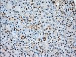 PFN1 Antibody in Immunohistochemistry (Paraffin) (IHC (P))