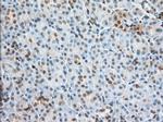 PFN1 Antibody in Immunohistochemistry (Paraffin) (IHC (P))