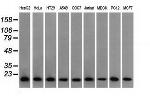 PFN1 Antibody in Western Blot (WB)