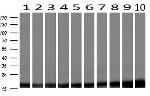 PFN1 Antibody in Western Blot (WB)