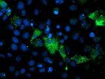 PGAM2 Antibody in Immunocytochemistry (ICC/IF)