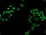 PGAM2 Antibody in Immunocytochemistry (ICC/IF)