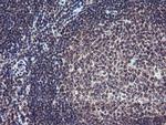 PGAM2 Antibody in Immunohistochemistry (Paraffin) (IHC (P))