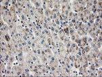 PGAM2 Antibody in Immunohistochemistry (Paraffin) (IHC (P))