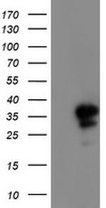 PGAM2 Antibody in Western Blot (WB)