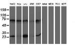 PGAM2 Antibody in Western Blot (WB)