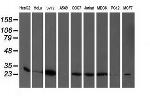 PGAM2 Antibody in Western Blot (WB)