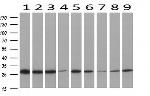 PGAM2 Antibody in Western Blot (WB)