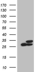 PGAM4 Antibody in Western Blot (WB)