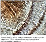 PGAP3 Antibody in Immunohistochemistry (IHC)