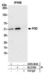 PGD Antibody in Western Blot (WB)