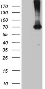 PGM2L1 Antibody in Western Blot (WB)