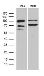 PGM2L1 Antibody in Western Blot (WB)