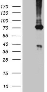 PGM2L1 Antibody in Western Blot (WB)