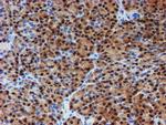 PGM3 Antibody in Immunohistochemistry (Paraffin) (IHC (P))