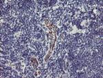 PGM3 Antibody in Immunohistochemistry (Paraffin) (IHC (P))