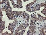 PGM3 Antibody in Immunohistochemistry (Paraffin) (IHC (P))