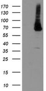 PGM3 Antibody in Western Blot (WB)