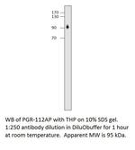 Progesterone Receptor Antibody in Western Blot (WB)