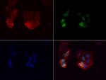 PGR Antibody in Immunocytochemistry (ICC/IF)