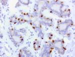 PGR Antibody in Immunohistochemistry (Paraffin) (IHC (P))