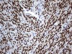 PGR Antibody in Immunohistochemistry (Paraffin) (IHC (P))