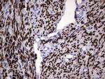 PGR Antibody in Immunohistochemistry (Paraffin) (IHC (P))