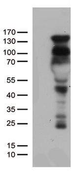 PGR Antibody in Western Blot (WB)