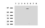 PGR Antibody in Western Blot (WB)