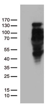 PGR Antibody in Western Blot (WB)
