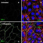 Human IFN-gamma Protein in Functional Assay (FN)