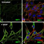 Human VEGF-165 Protein in Functional Assay (FN)