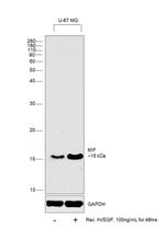 Human VEGF-165 Protein in Functional Assay (FN)