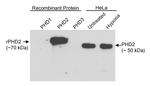 PHD2 Antibody in Western Blot (WB)