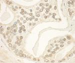 PHF23 Antibody in Immunohistochemistry (IHC)