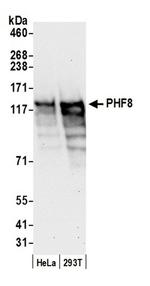 PHF8 Antibody in Western Blot (WB)