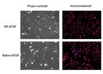 Human Heat Stable bFGF Protein in Functional Assay (Functional)