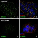 Human TGF-beta 1 Protein in Functional Assay (FN)