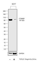 Human TGF-beta 1 Protein in Functional Assay (FN)