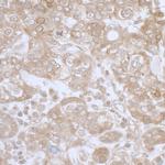 PHGDH Antibody in Immunohistochemistry (IHC)