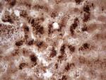 PHGDH Antibody in Immunohistochemistry (Paraffin) (IHC (P))