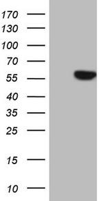 PHGDH Antibody in Western Blot (WB)